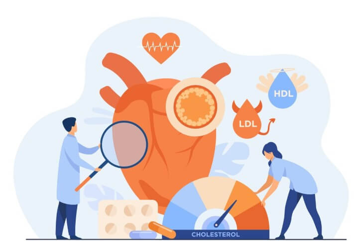 콜레스테롤 검사