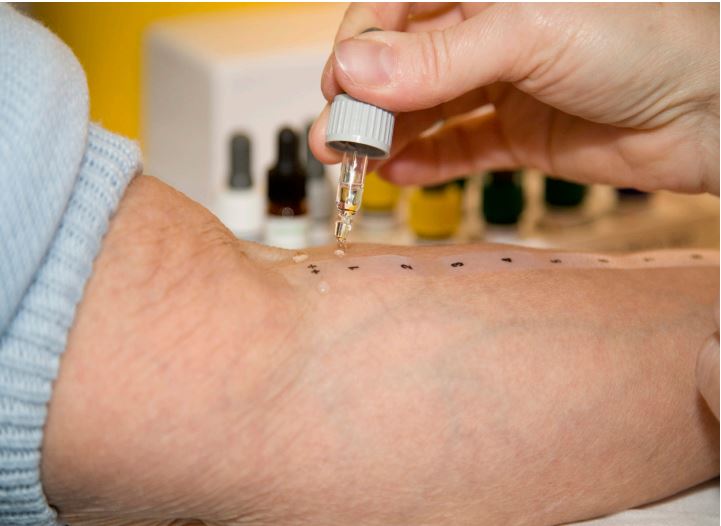 음식물 과민증 검사 원인&amp;#44; 증상&amp;#44; 검사 방법 및 식단 관리 가이드