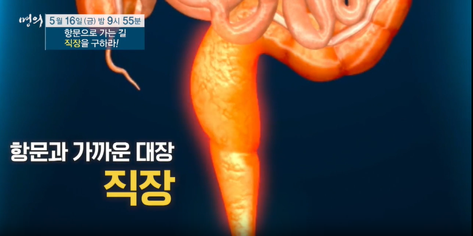 명의-항문으로 가는길, 직장을 구하라