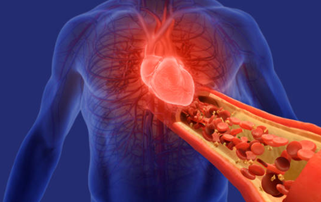 황반변성 증상 치료법 황반변성 자가진단 장애등급 수술 및 비용 원인