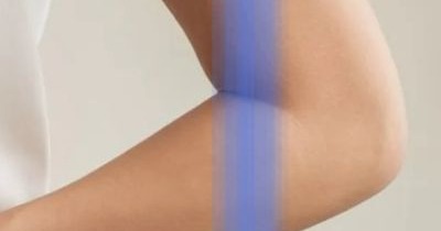 탈장이란&amp;#44; 증세