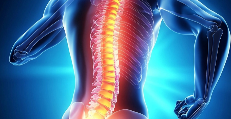 허리디스크에 2