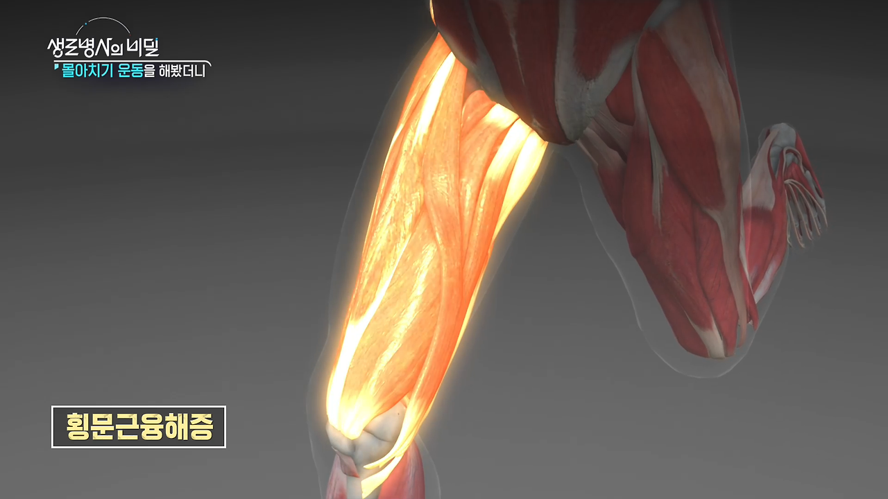 생로병사의 비밀 몰아치기 운동