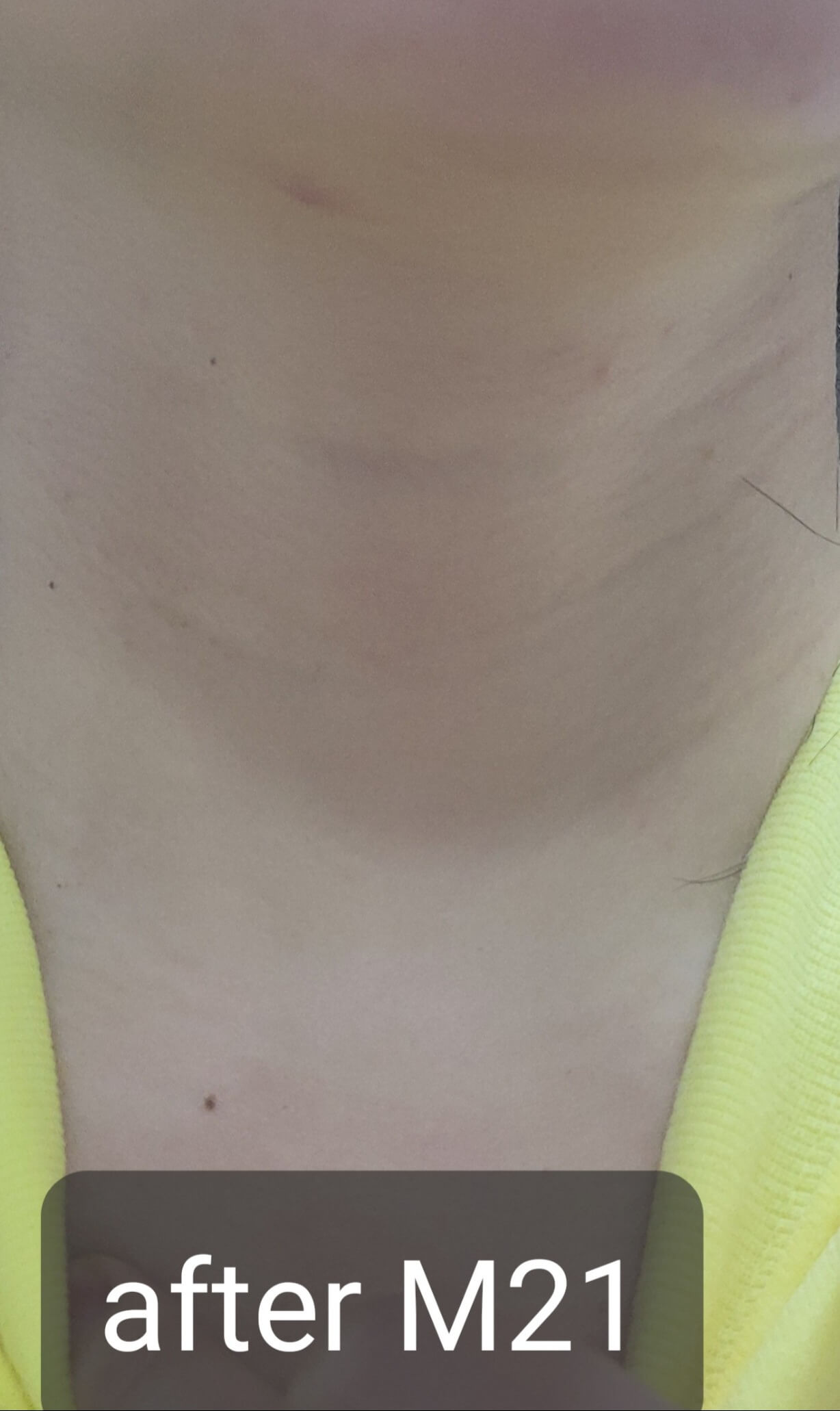 after usage for 21 days