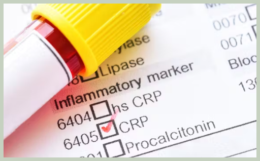 CRP 검사 결과 비정상인 경우