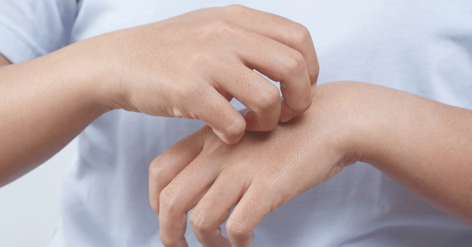 진드기물린후증상