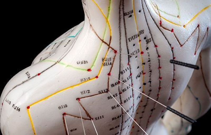 혈자리 인형에 침을 놓은 사진