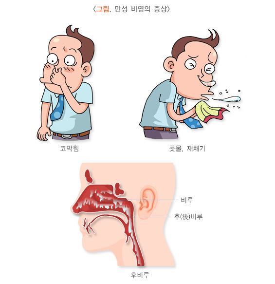 만성비염의-증상을-만화로-그린-그림