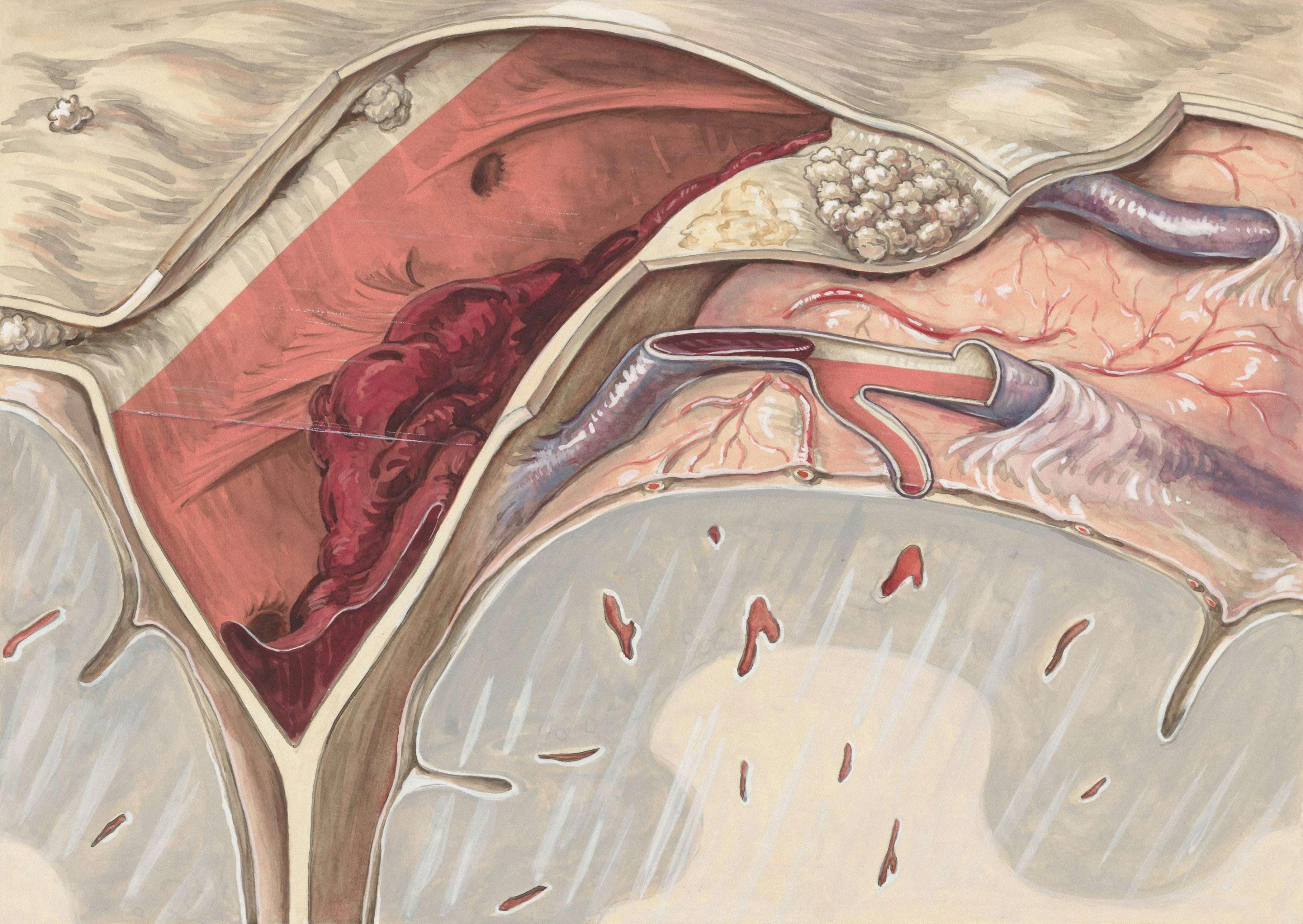 혈관 막힘 증상 5가지