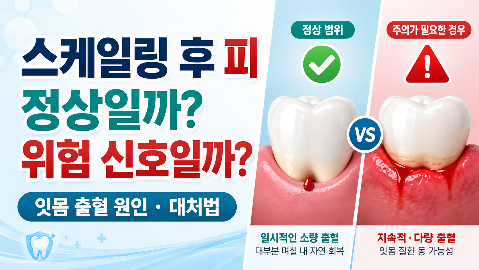 스케일링 후 피나는 이유 정상과 위험 신호
