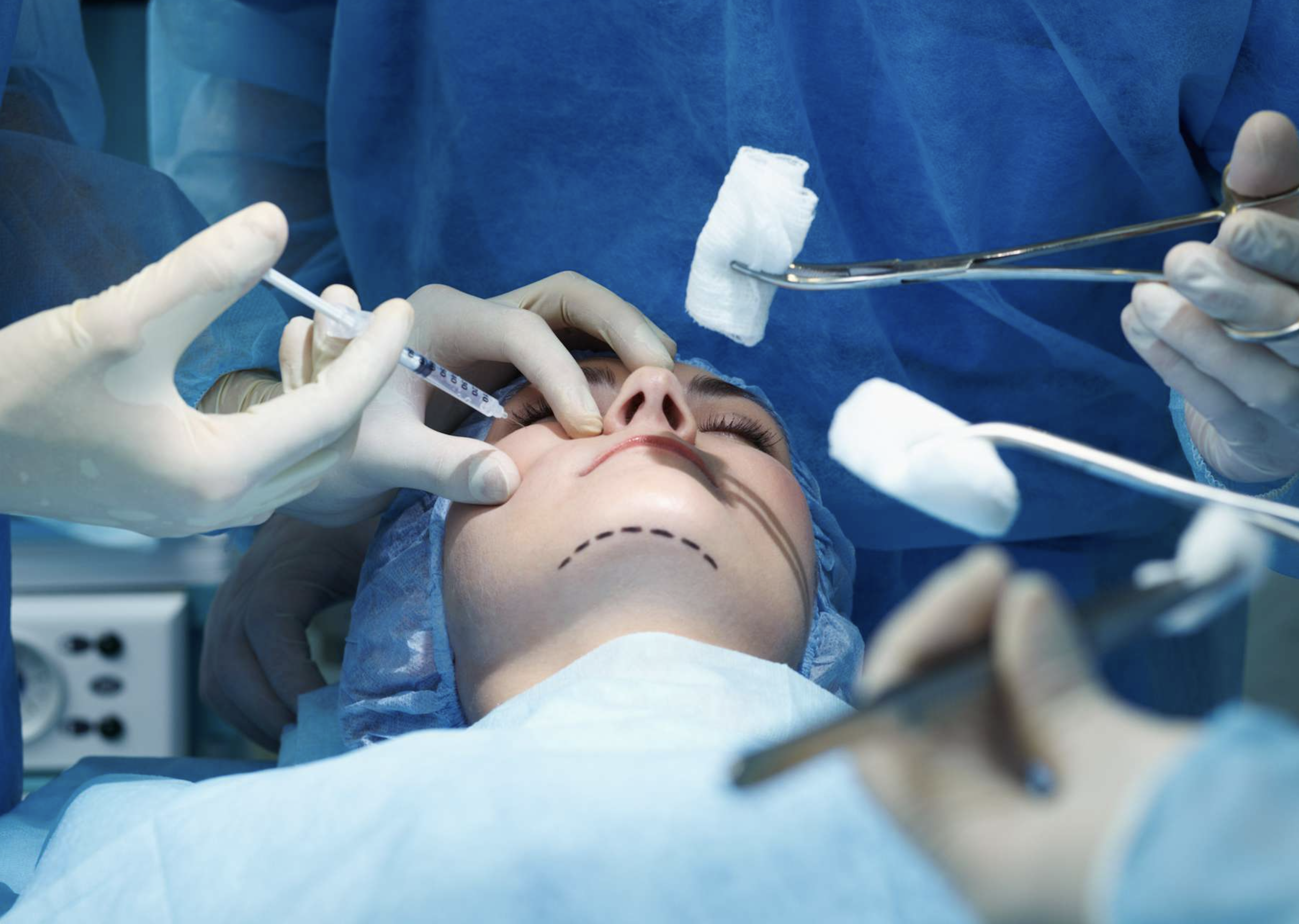 안면-거상술-부작용