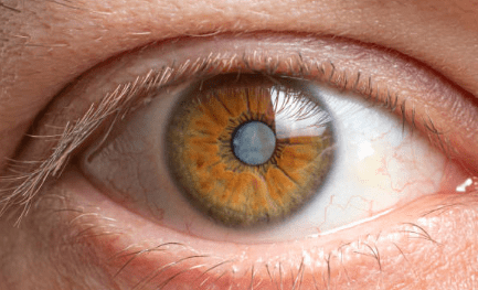 백내장 수술비용