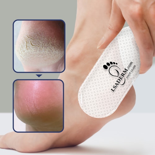 스크럽 또는 풋 파일로 각질 제거 