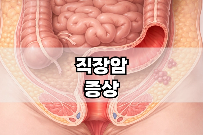 직장암 증상