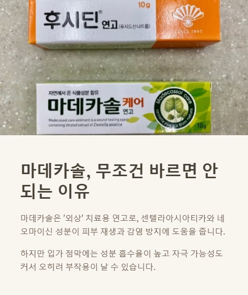 마데카솔 무조건 바르면 안 되는 이유