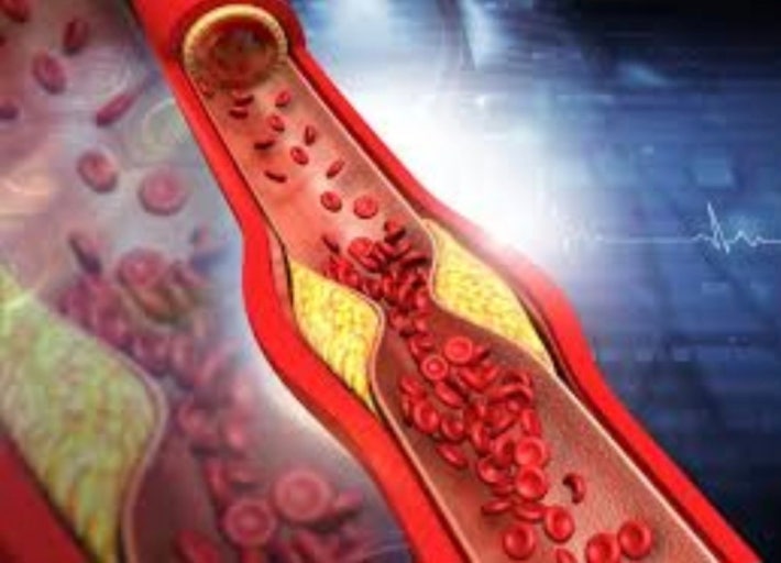 중성지방 수치 높은 이유와 낮추는 생활습관 7가지 관련 사진