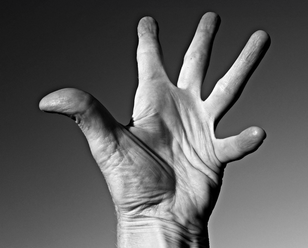 갱년기 관절통과 류마티스 비교