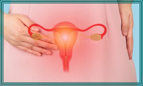 임신 중 질염 생기는 이유 10가지