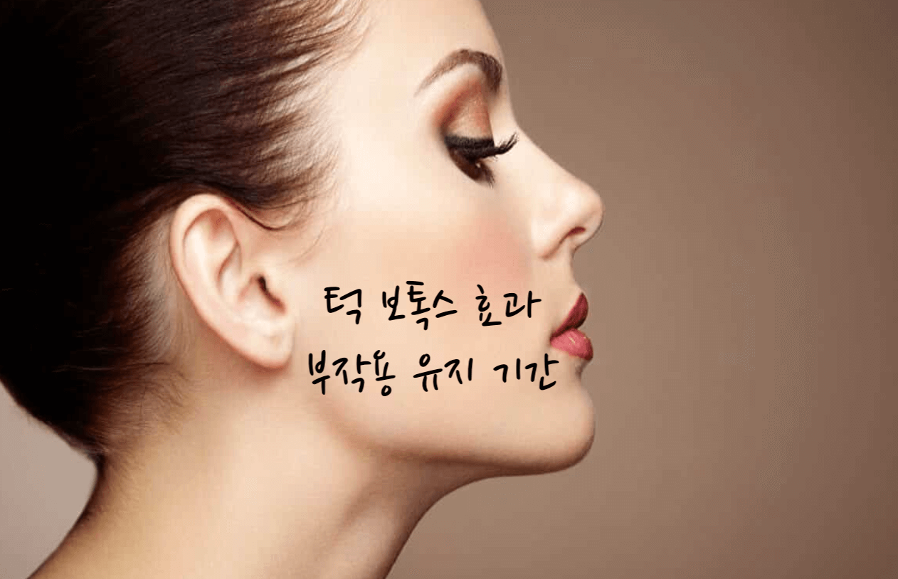턱 보톡스 효과