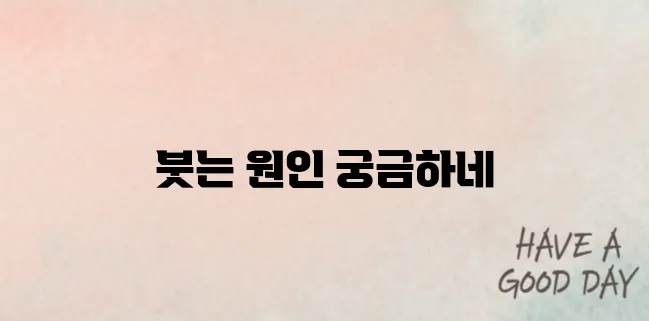 눈두덩이가 붓는 이유