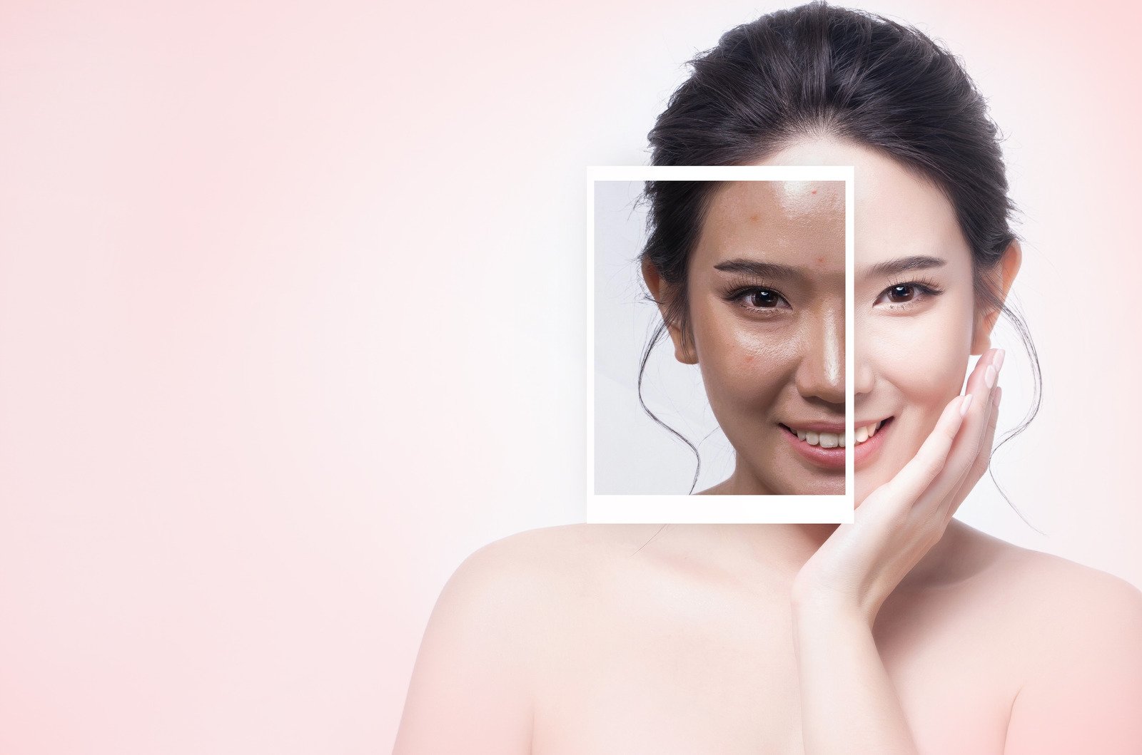 동안 피부를 위한 자외선 차단 관리