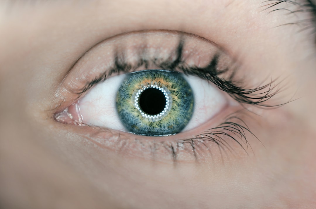 Under-eye.