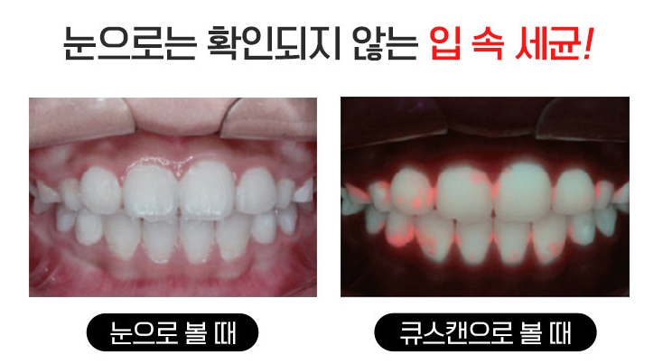 구강유산균