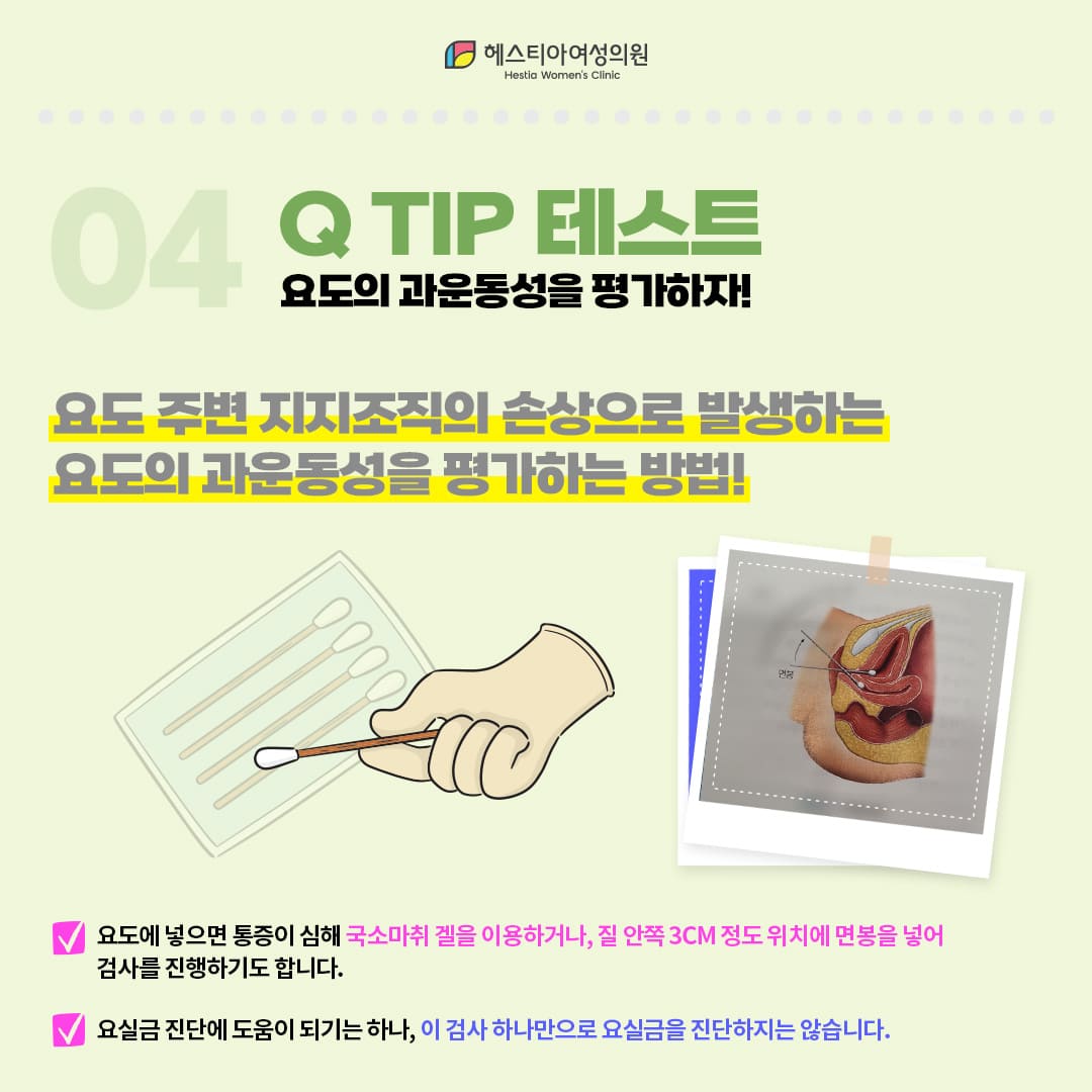노인요실금
요실금병원
Q-TIP 테스트