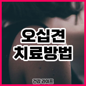 오십견 치료방법