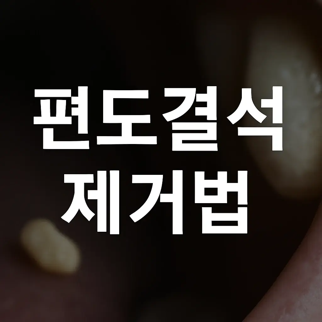 편도결석 제거법