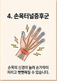 류마티스 관절염 초기증상