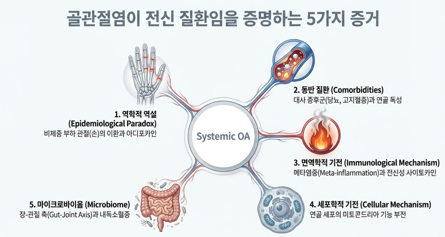 무릎 관절염 5가지 증거 구로디지털단지한의원