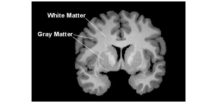 뇌의 회백질과 백질 출처 교육을바꾸는사람들