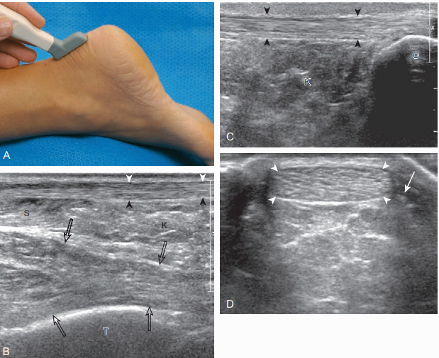 뒤쪽발목검사(posterior ankle evaluation)