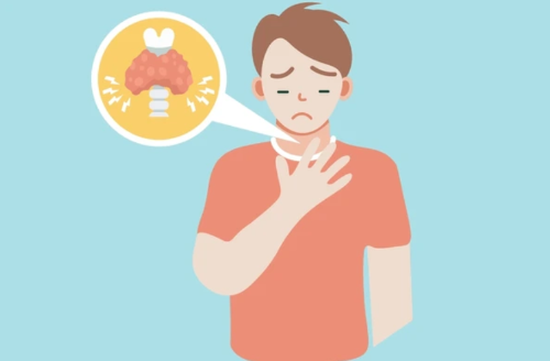 갑상선이 부은 남자를 표현한 인포그래픽