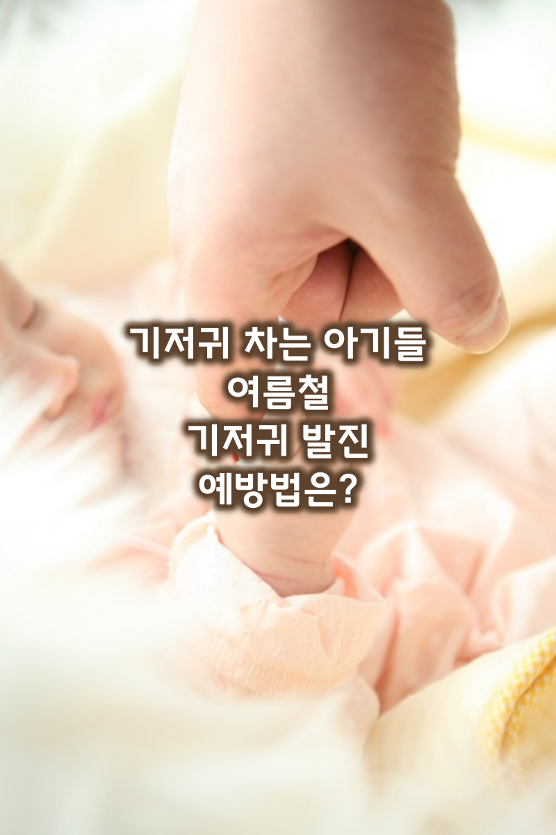 기저귀발진예방