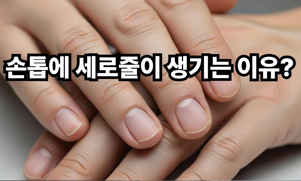 손톱에 세로줄이 생기는 이유 사진 1