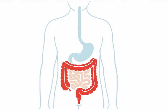 대장암에 좋은 음식과 안 좋은 음식