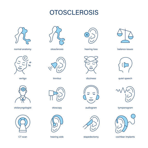 평촌 이경화증 수술? 비용, 기간, 부작용까지 한 번에!