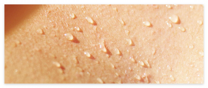 땀이-많이-나는-이유