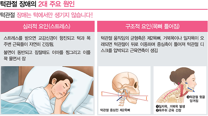 턱관절 장애의 2대 주요 원인