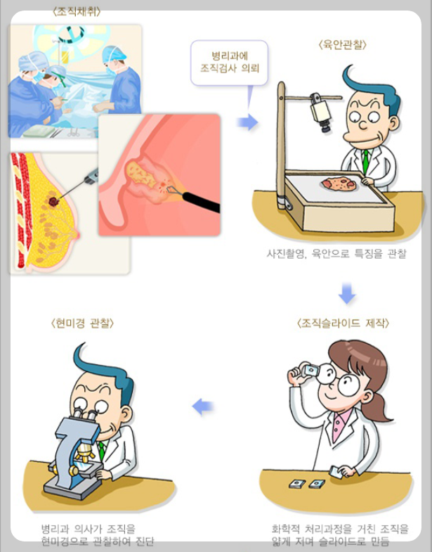 위내시경 검사 과정
