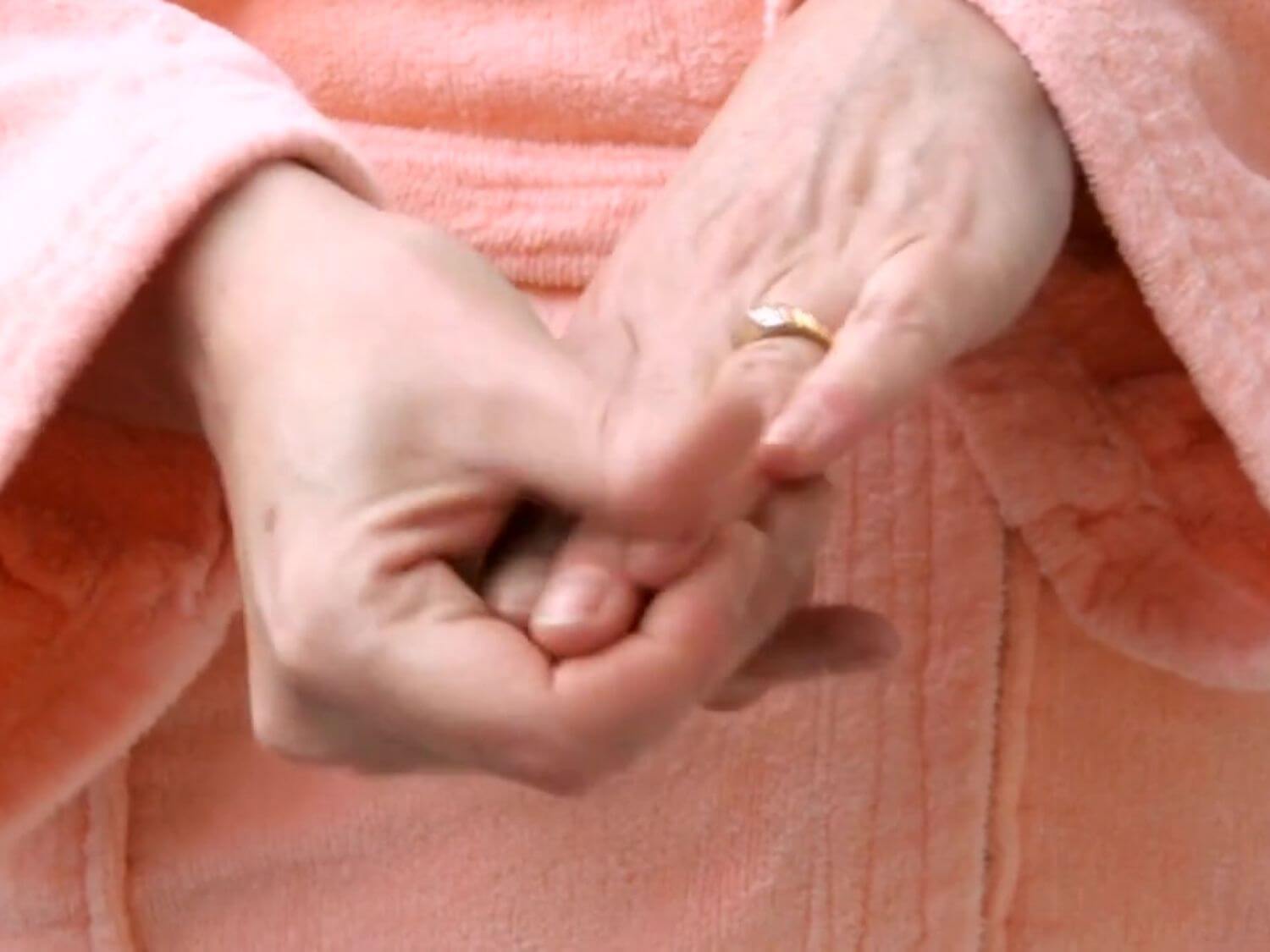 손가락 퇴행성 관절염