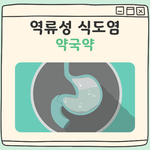 역류성 식도염 약국약 대표 이미지