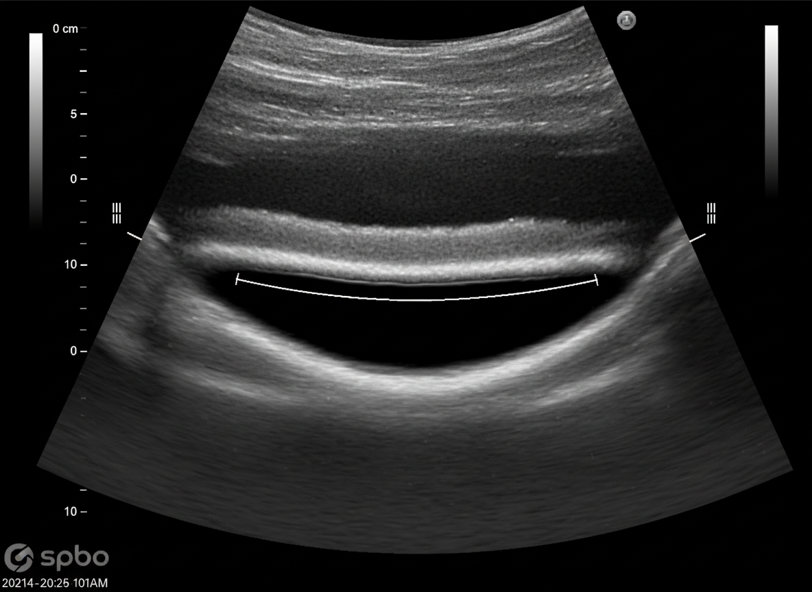 과학으로 본 콘드로이친 효과! 연골 보호부터 통증 완화까지!
