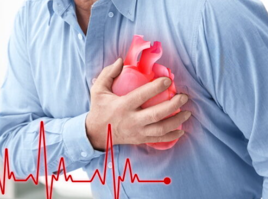 심혈관 질환 예방