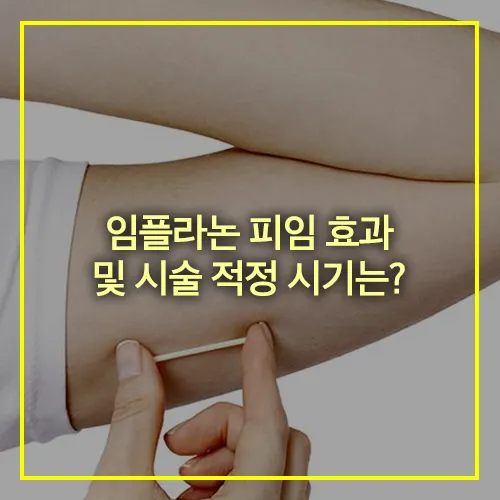 임플라논 피임 효과 시술 적정 시기