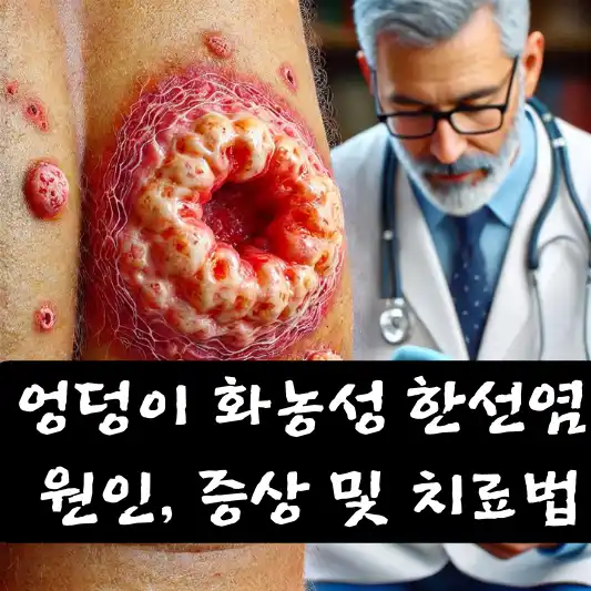 엉덩이 화농성 한선염 증상 원인