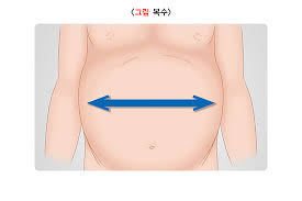 간수치가 높으면 나타나는 증상