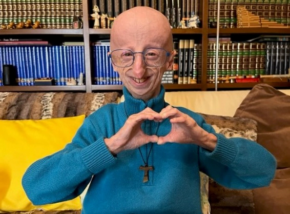 소아 조로증 수명 및 소아조로증 원인과 치료방법